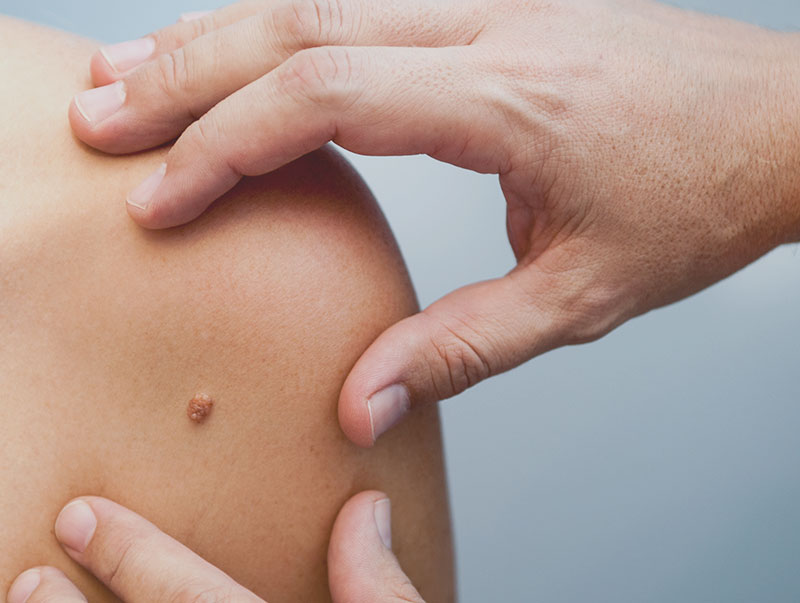 Maladies de la peau et du cuir chevelu