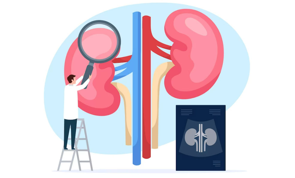 Maladies lithiasiques