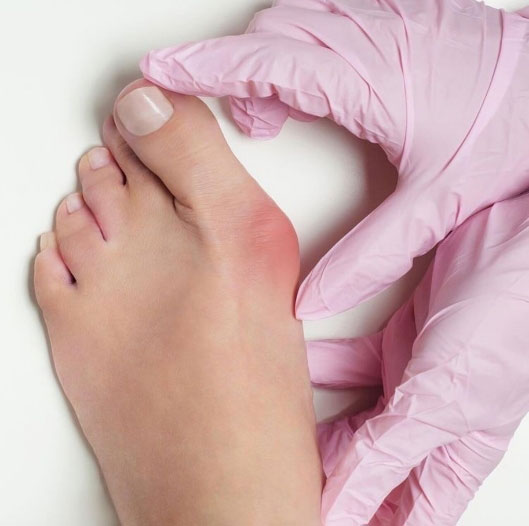 Chirurgie du pied
